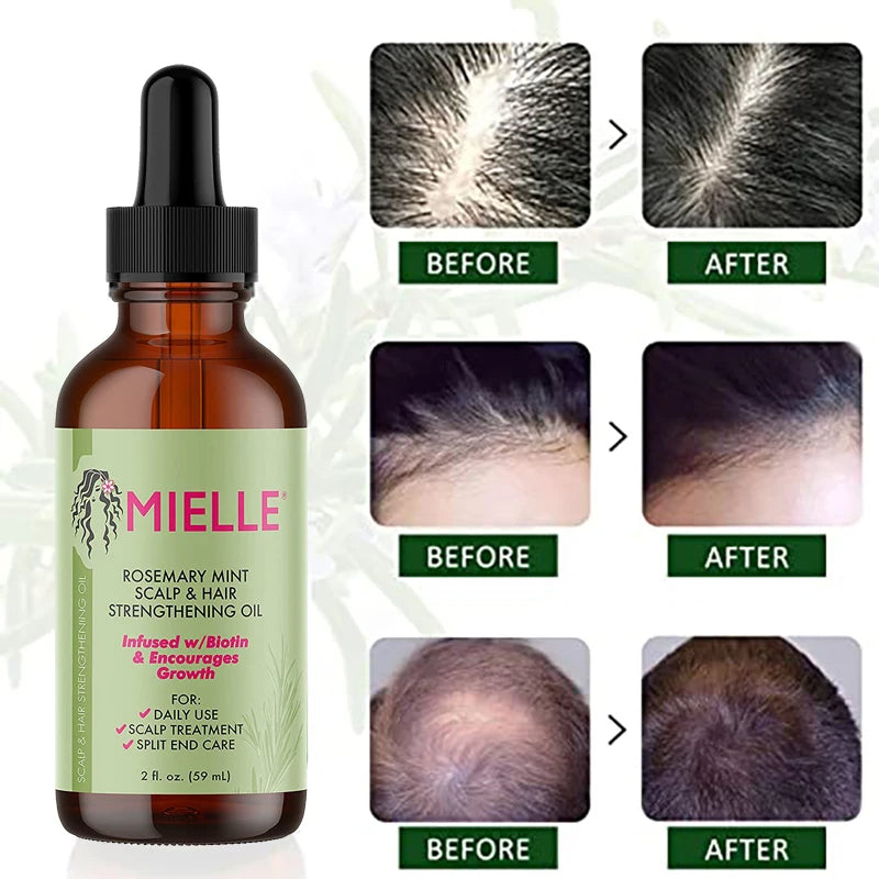 Free Gift - Rosemary Hair Growth Essential Oil