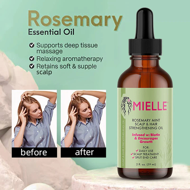 Free Gift - Rosemary Hair Growth Essential Oil